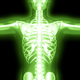 Illustration for article titled What Nuclear Radiation Does To Your Body